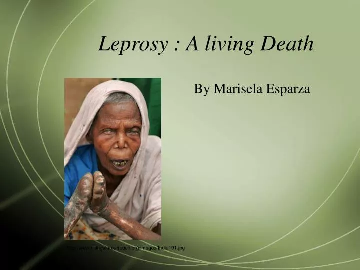 leprosy a living death