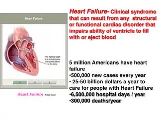 Heart Failure Click here!
