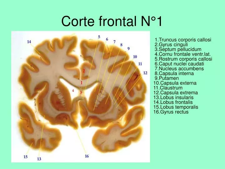 corte frontal n 1
