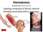 Hematoma he·ma·to·ma / (haematˈtō-mə)