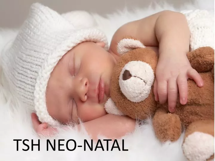 tsh neo natal