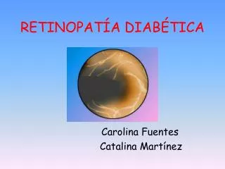 retinopat a diab tica