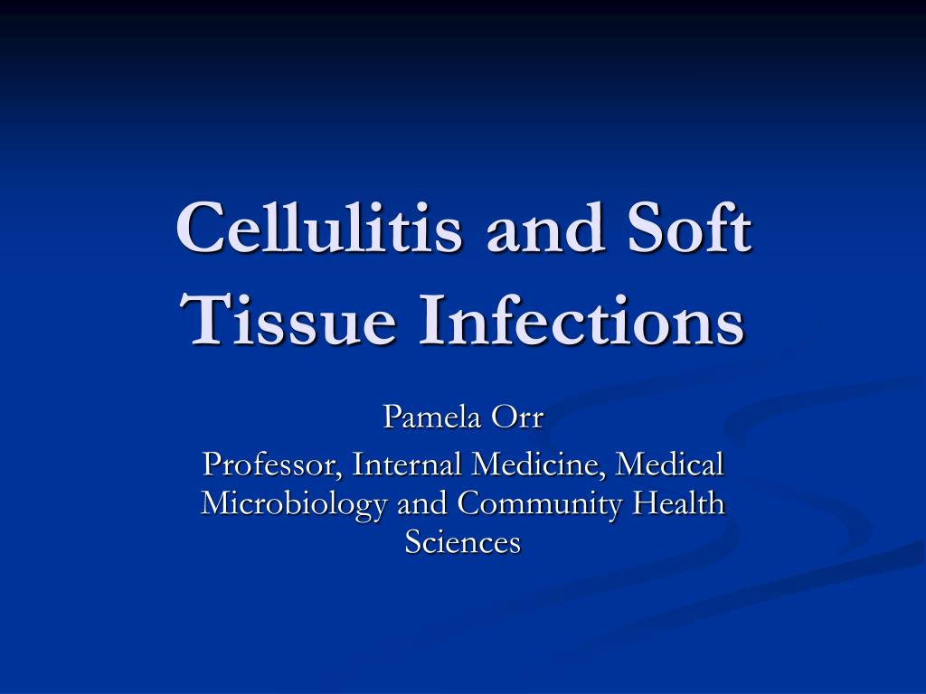 PPT - Cellulitis and Soft Tissue Infections PowerPoint Presentation ...