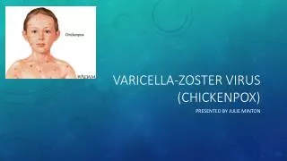 VARicella - zoster virus (chickenpox)
