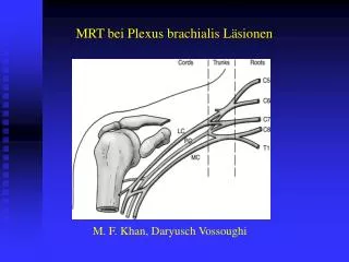 mrt bei plexus brachialis l sionen