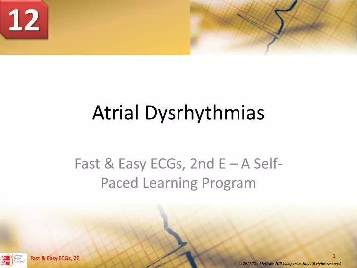 atrial dysrhythmias