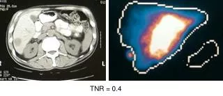 TNR = 0.4