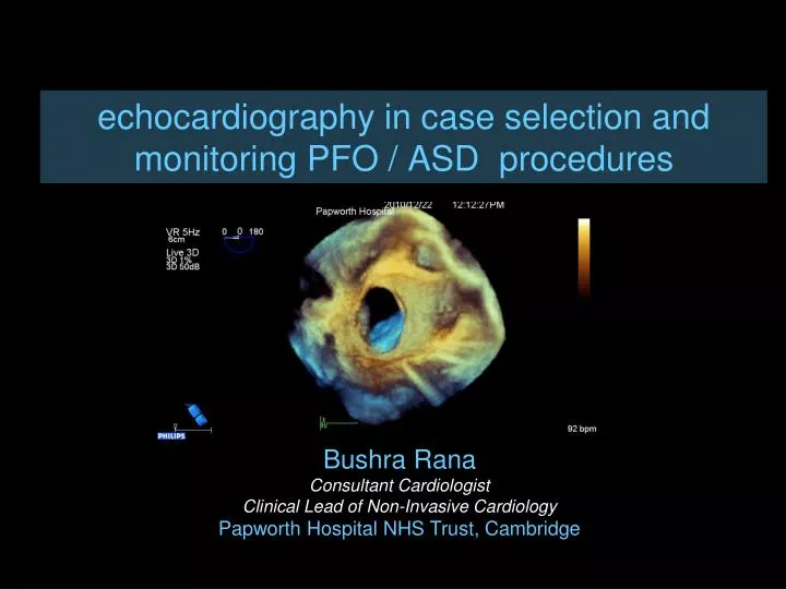 echocardiography in case selection and monitoring pfo asd procedures