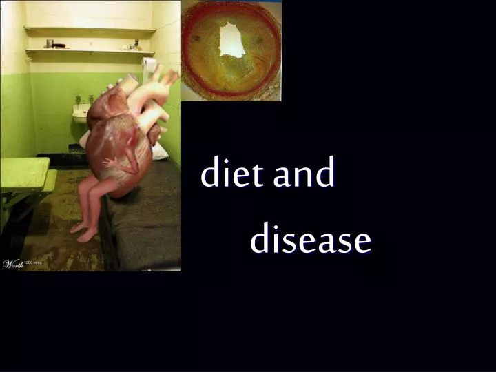 diet and disease