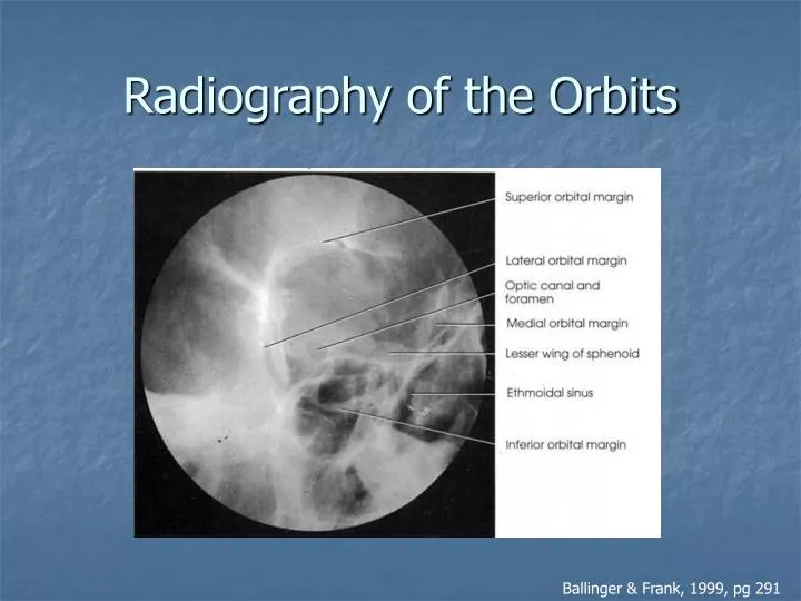 radiography of the orbits