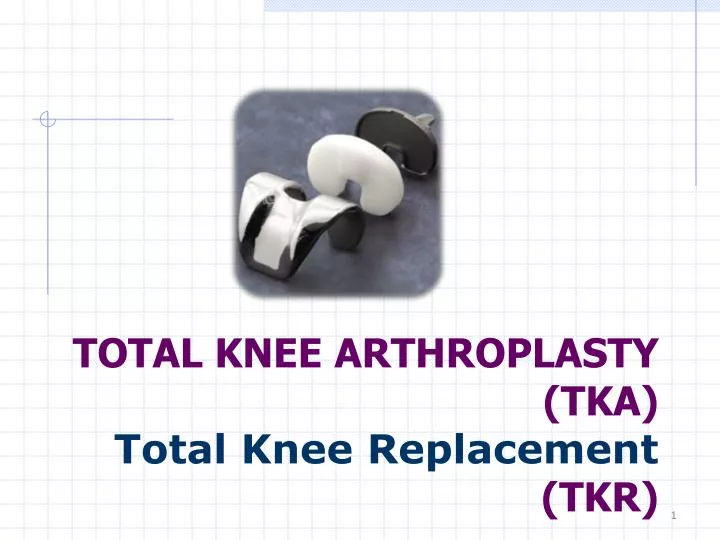 total knee arthroplasty tka total knee replacement tkr