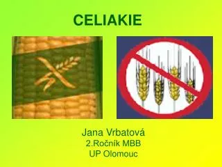 jana vrbatov 2 ro n k mbb up olomouc