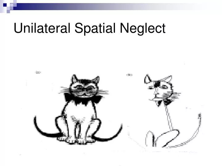 unilateral spatial neglect