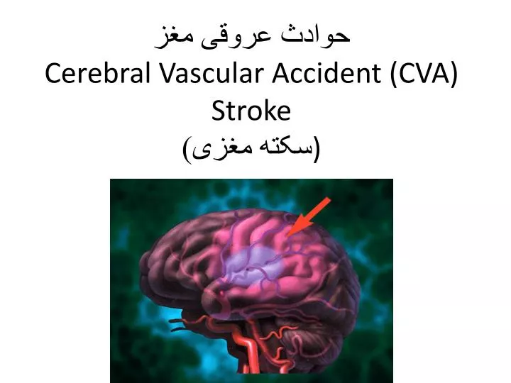 cerebral v ascular accident cva stroke