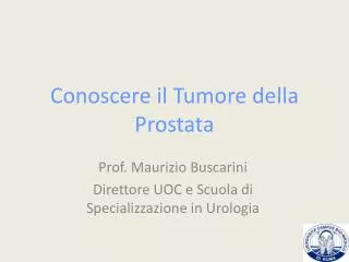 conoscere il tumore della prostata
