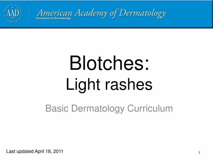 blotches light rashes