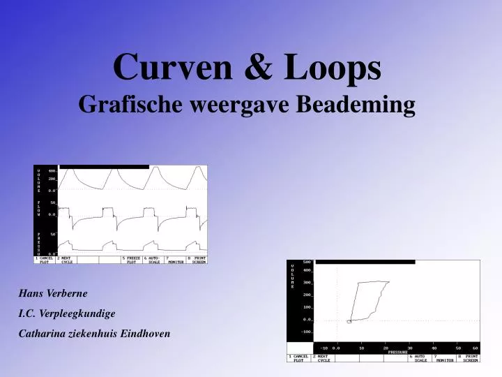 curven loops grafische weergave beademing