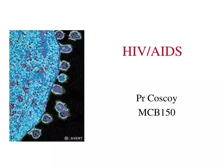 hiv aids