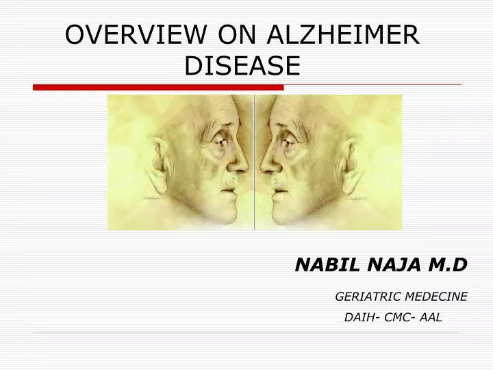 overview on alzheimer disease