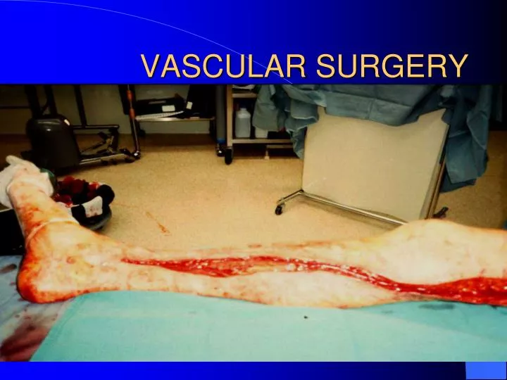 vascular surgery
