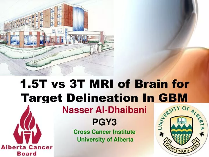 1 5t vs 3t mri of brain for target delineation in gbm