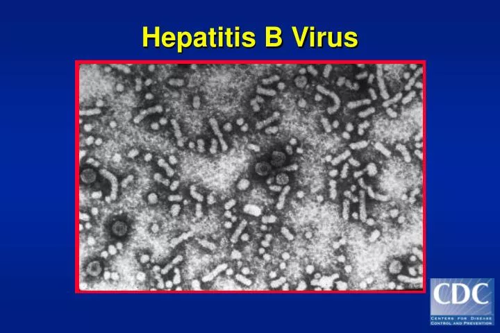 PPT - Hepatitis B Virus PowerPoint Presentation, Free Download - ID:5687828