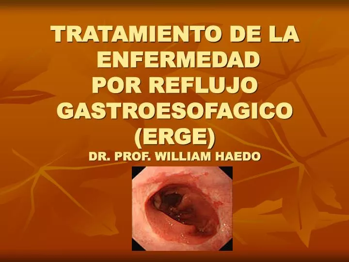tratamiento de la enfermedad por reflujo gastroesofagico erge dr prof william haedo