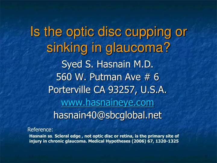 is the optic disc cupping or sinking in glaucoma