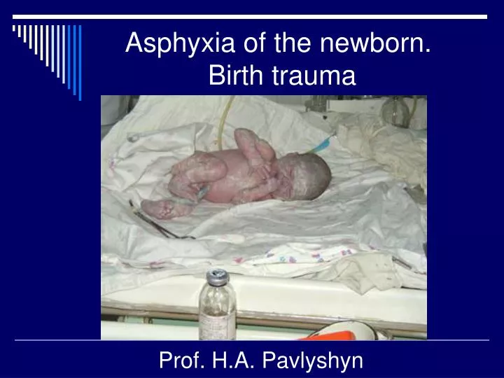 PPT - Asphyxia Of The Newborn. Birth Trauma PowerPoint Presentation ...