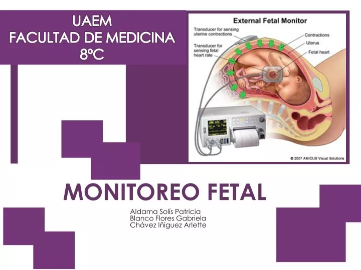 monitoreo fetal