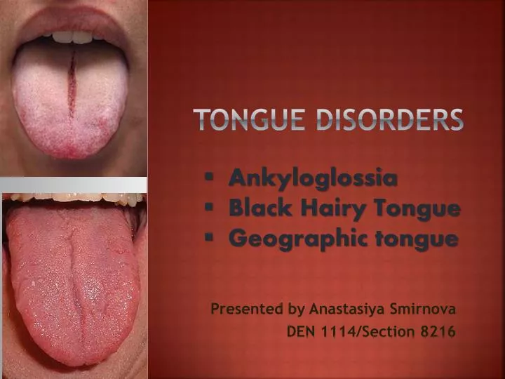 tongue disorders