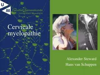 cervicale myelopathie
