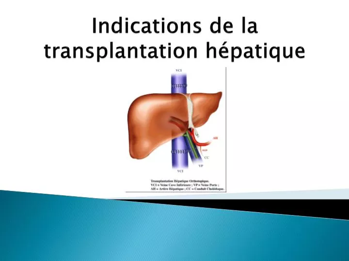 indications de la transplantation h patique