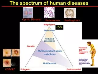 The spectrum of human diseases