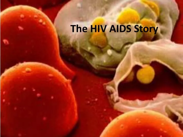 the hiv aids story
