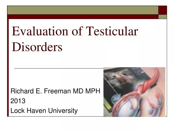 evaluation of testicular disorders
