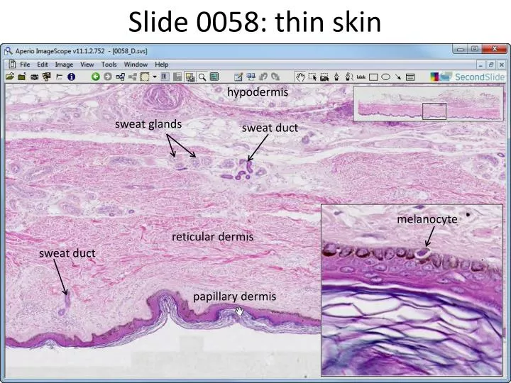 slide 0058 thin skin