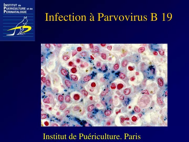 infection parvovirus b 19
