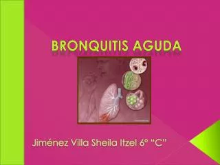 PPT - BRONQUITIS AGUDA PowerPoint Presentation, Free Download - ID:187054