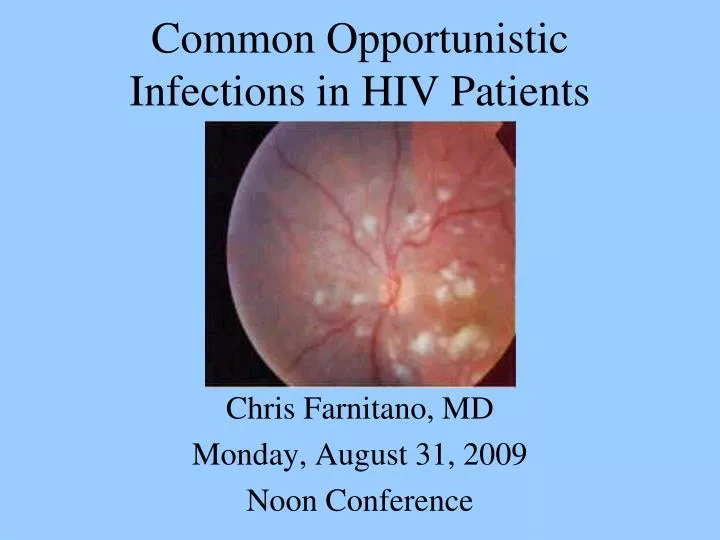 common opportunistic infections in hiv patients