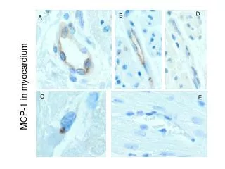 MCP-1 in myocardium