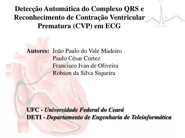 detec o autom tica do complexo qrs e reconhecimento de contra o ventricular prematura cvp em ecg