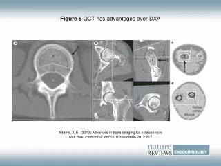 Figure 6 QCT has advantages over DXA