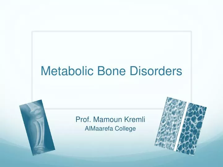 metabolic bone disorders