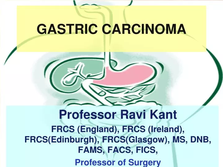 gastric carcinoma