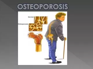 osteoporosis