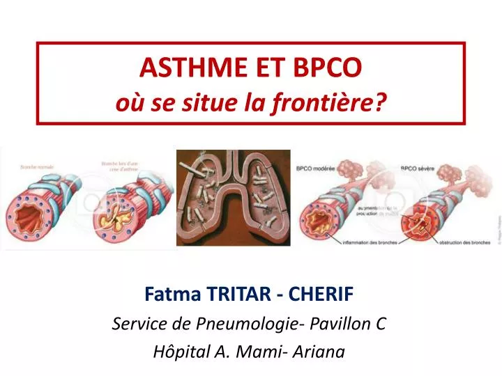 asthme et bpco o se situe la fronti re