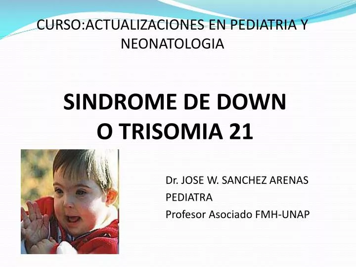 sindrome de down o trisomia 21