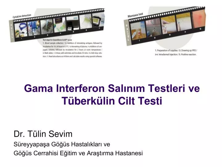 gama interferon sal n m testleri ve t berk lin cilt testi