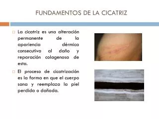 fundamentos de la cicatriz